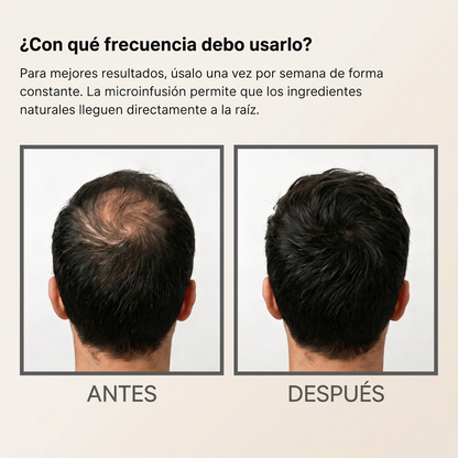 Elevo™ Sistema de Crecimiento Capilar