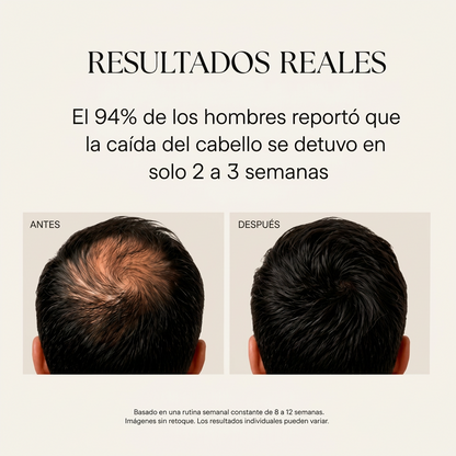 Elevo™ Sistema de Crecimiento Capilar
