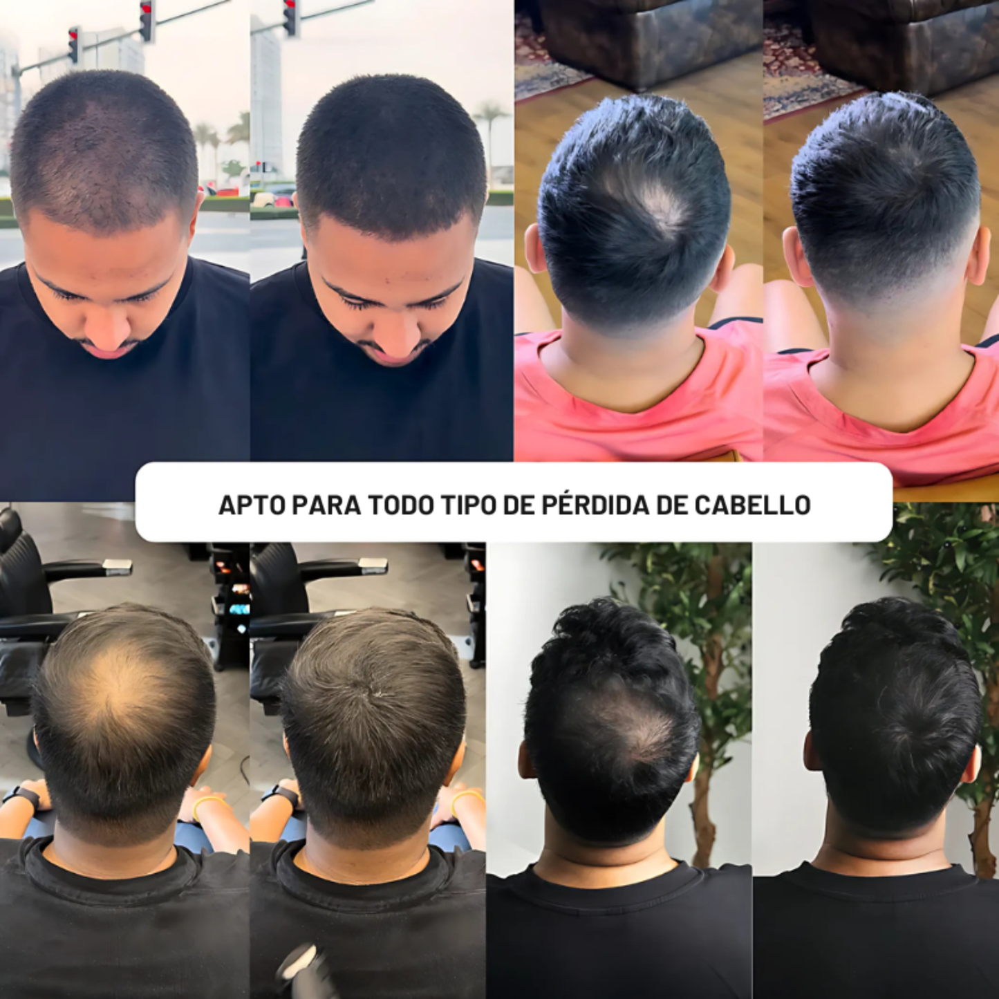Polvo Densificador Capilar